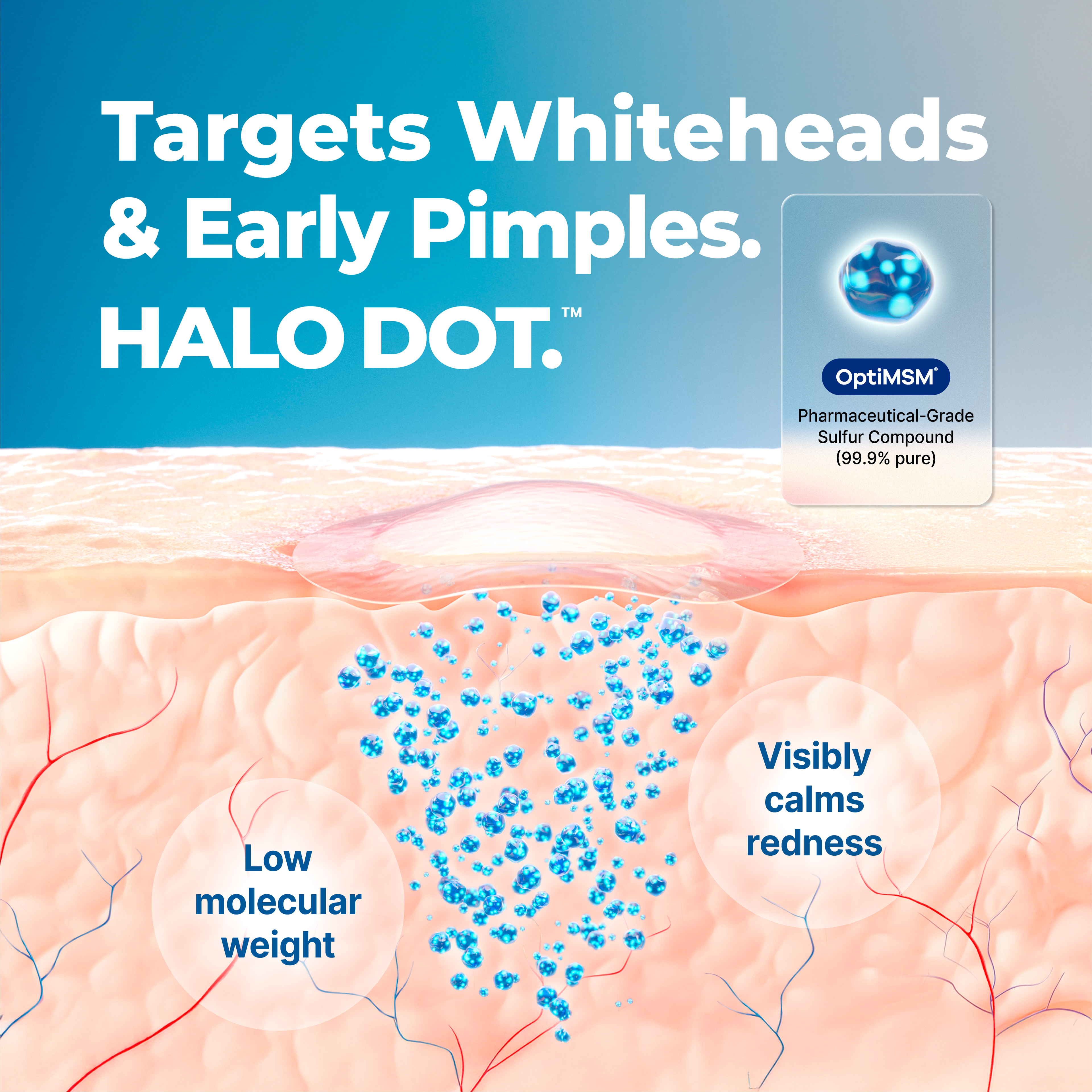HALO DOT™ Advanced Hydrocolloid Pimple Patches
